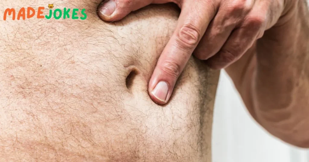 Best Hernia Jokes